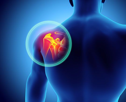 Shoulder replacement surgery