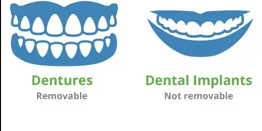 dentures and implants..