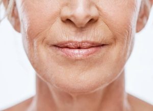 Face Taping Wrinkles